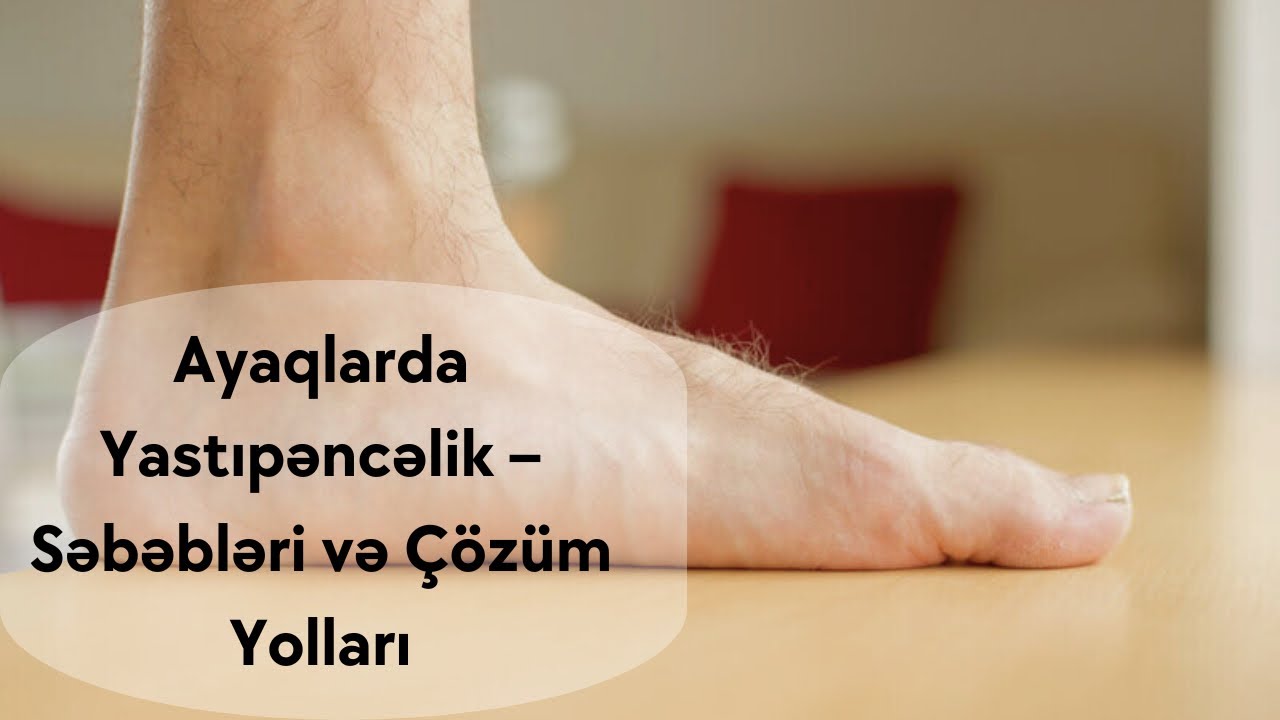 Ayaqlarda Yastıpəncəlik - Səbəbləri və Çözüm Yolları