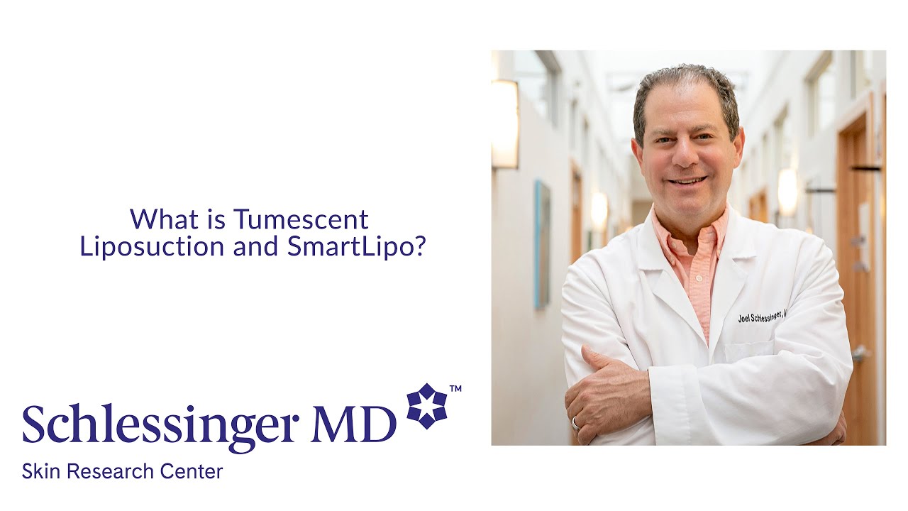 SchlessingerMD | What is Tumescent Liposuction and SmartLipo?