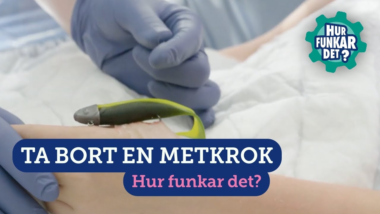 Ta bort en metkrok