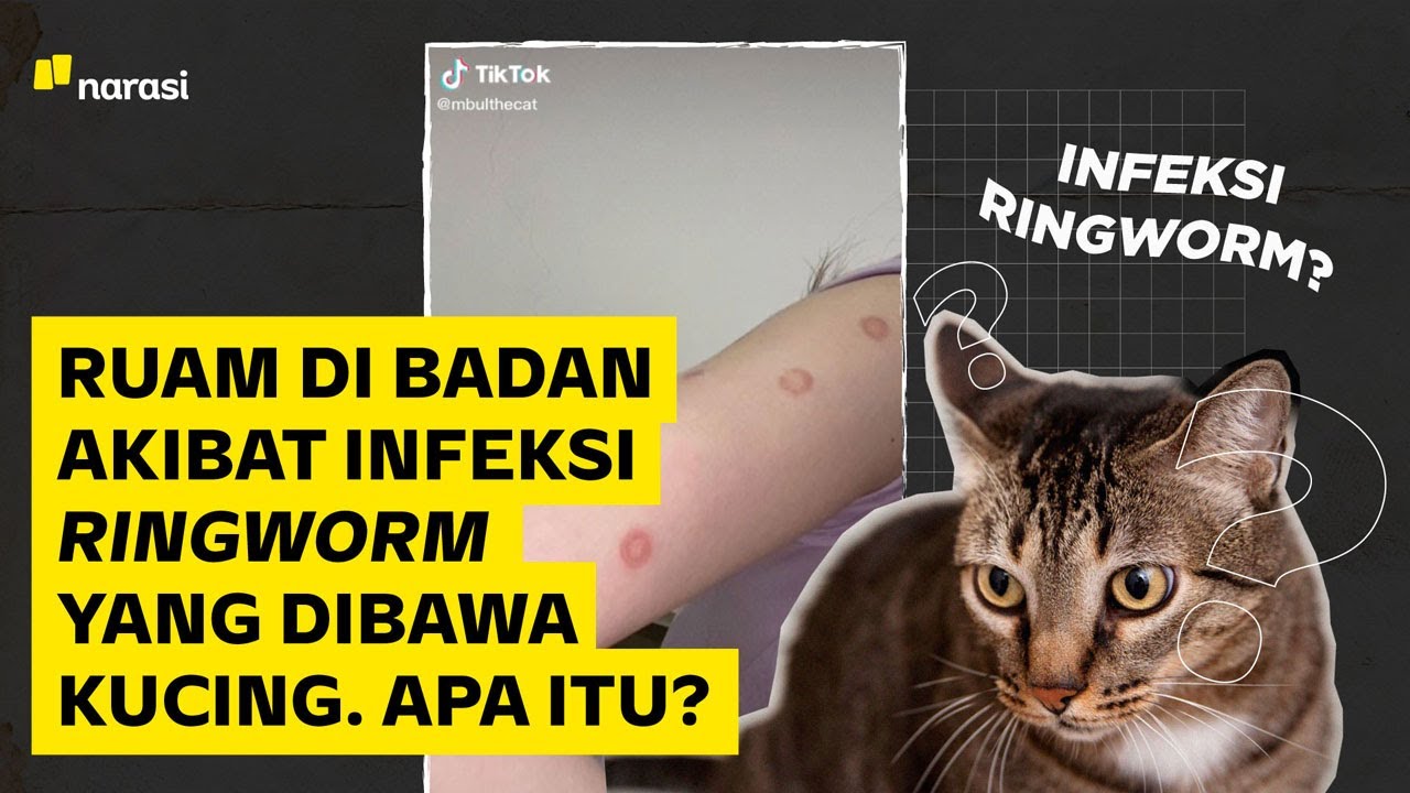 Ruam di Badan Akibat Infeksi Ringworm yang Dibawa Kucing. Apa Itu? | Narasi Daily