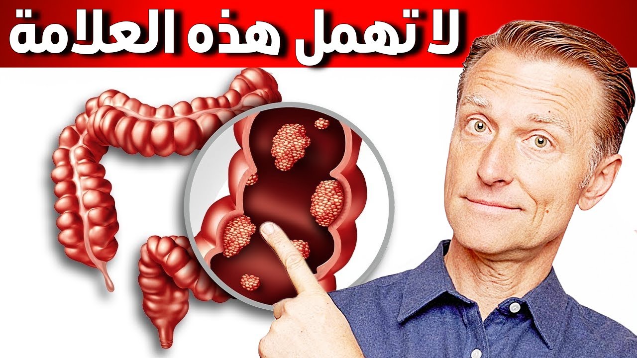 أول أعراض سرطان القولون