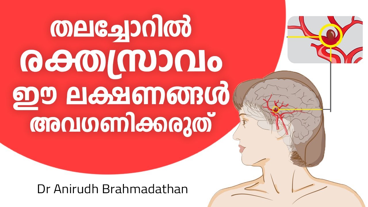 തലച്ചോറിലെ രക്തസ്രാവം - ഈ ലക്ഷണങ്ങൾ അവഗണിക്കരുത് | brain bleed