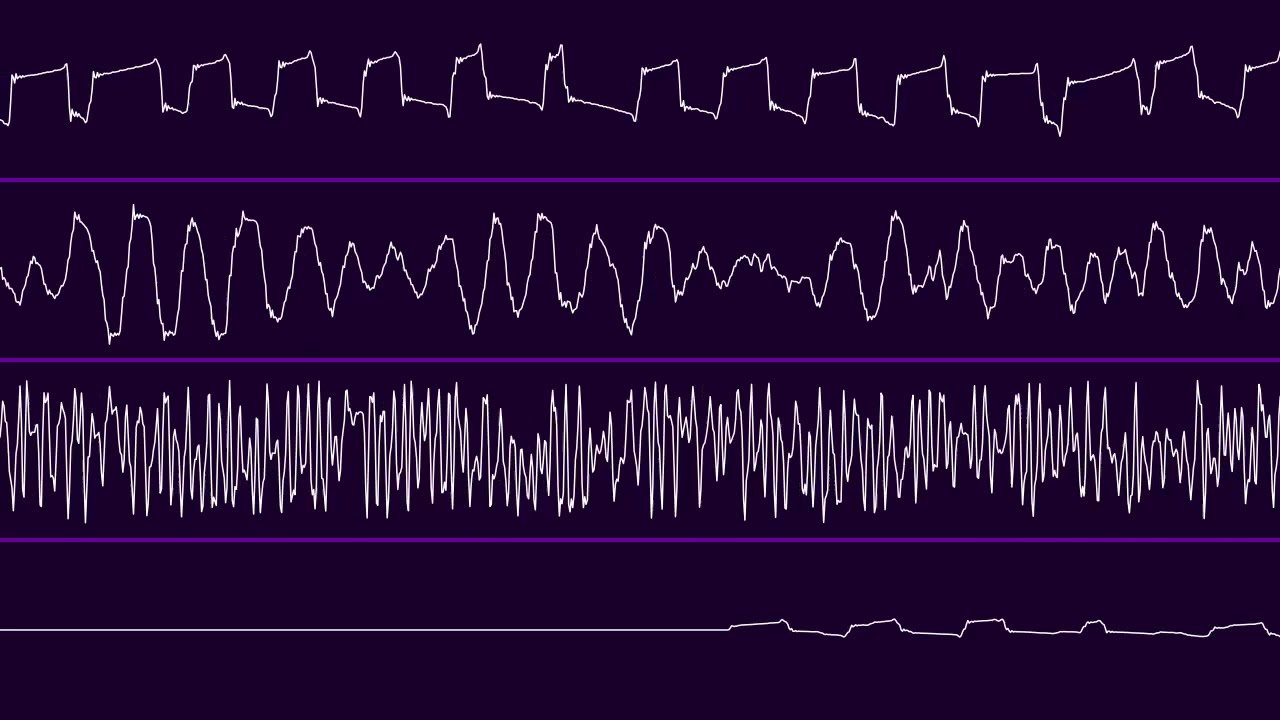 Muffler - austin powers [.MOD, Oscilloscope]