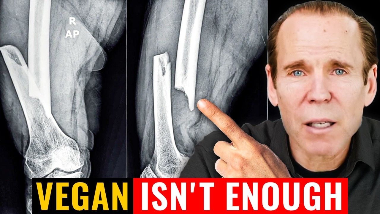 Why Most Vegan Diets Fail for Bone Health and What Actually Prevents Osteoporosis | Dr. Fuhrman