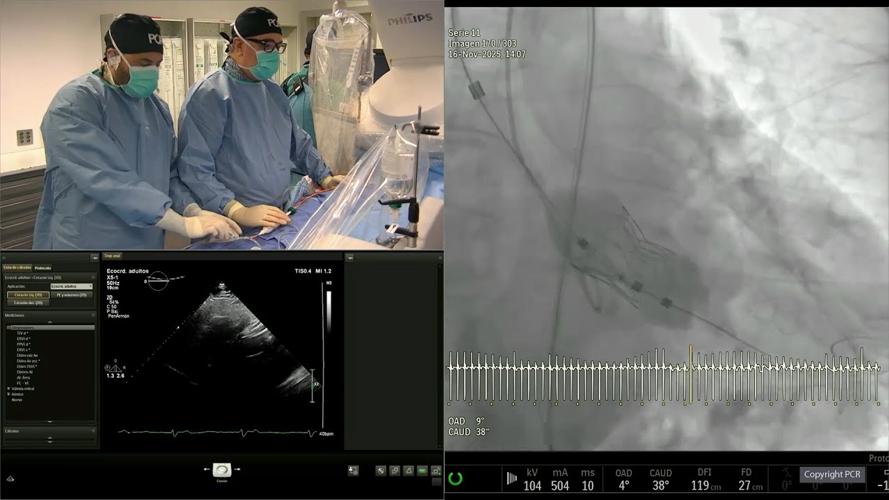 Align for the future with next gen Myval transcatheter heart valve series - PCR London Valves 2025