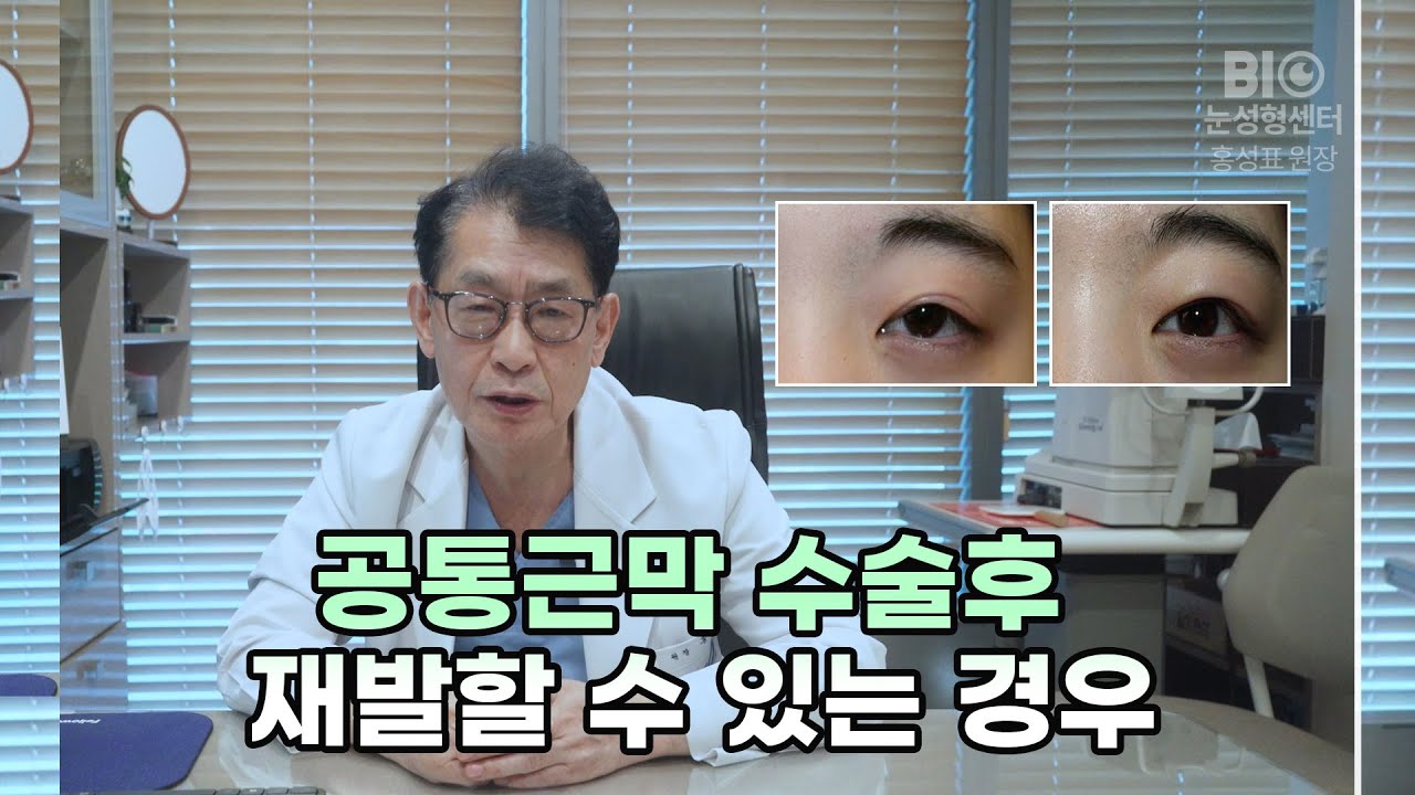 공통근막 수술후 재발할 수 있는 경우 - 비아이오성형외과 눈성형센터 홍성표원장