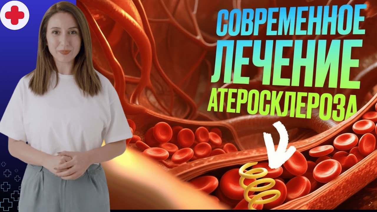 Атеросклероз сонных артерий — как лечат в 2026?