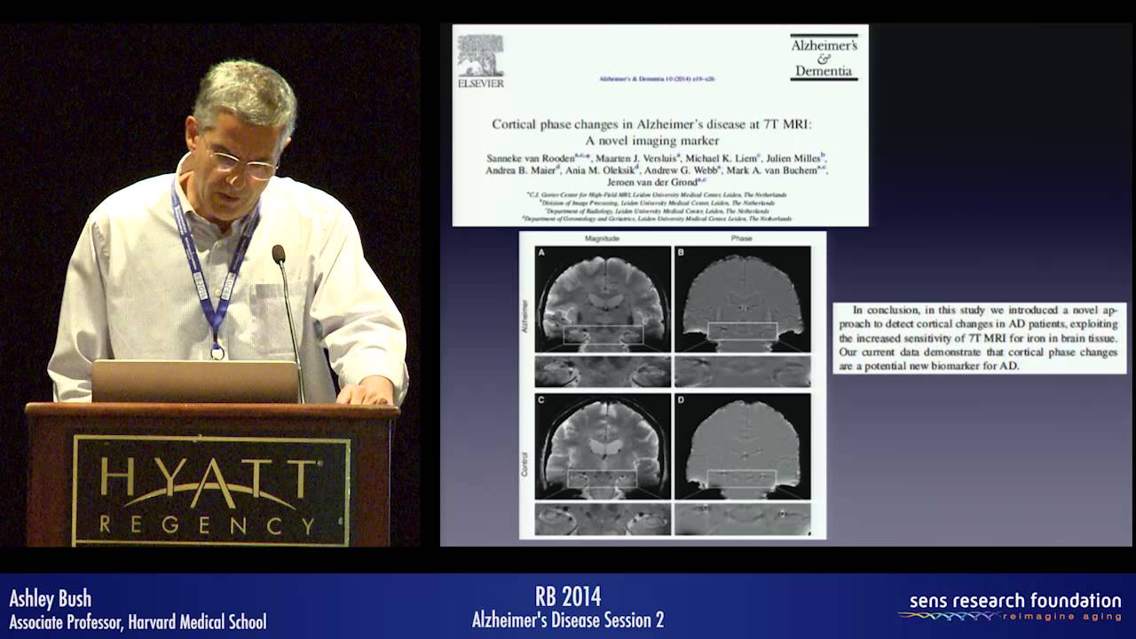 Iron in Aging and Neurodegenerative Disease - Ashley Bush