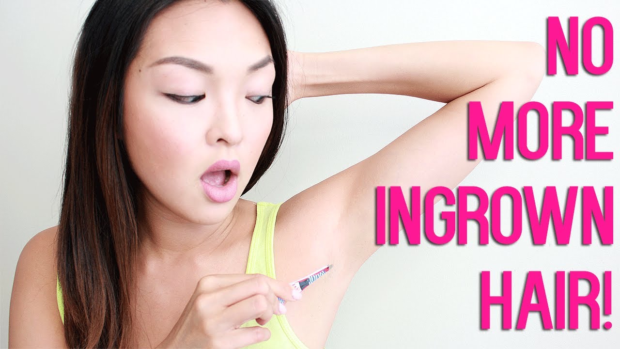 HOW TO: Get Rid of Ingrown Hairs