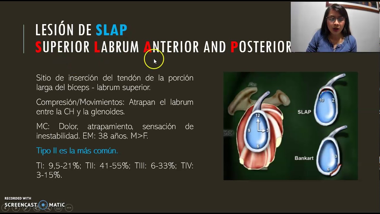 Lesiones del Labrum - Hombro