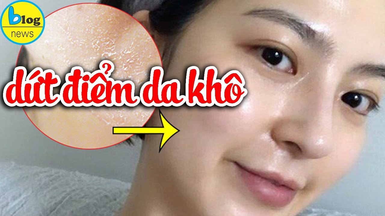 Chăm s&oacute;c da kh&ocirc; m&ugrave;a lạnh như thế n&agrave;o để da căng mướt