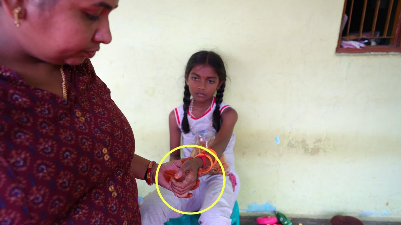 அச்சுவோட கை இப்போ இப்படி ஆகிடுச்சு ..  Dressing எல்லாமே போகிடிச்சு ...  Mrs.Abi