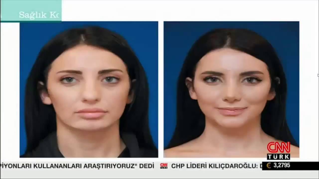 Örümcek Ağı Operasyonu İle Öncesi Sonrası