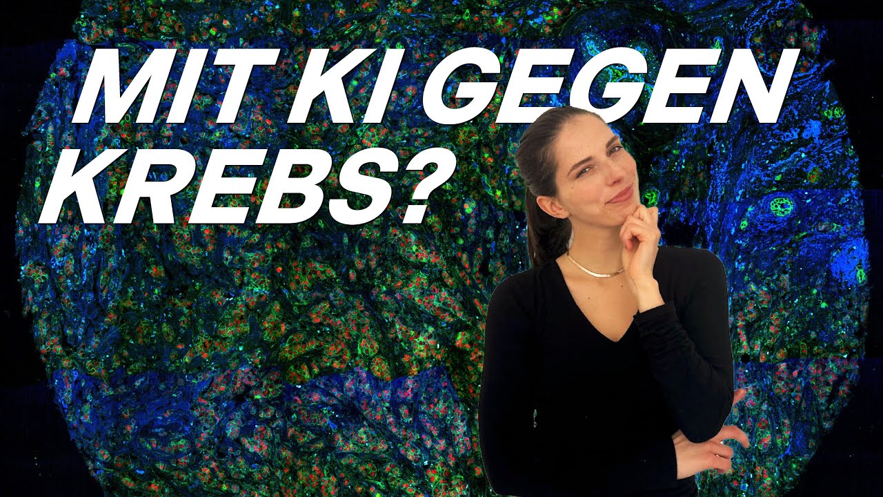 Mit KI gegen Krebs?