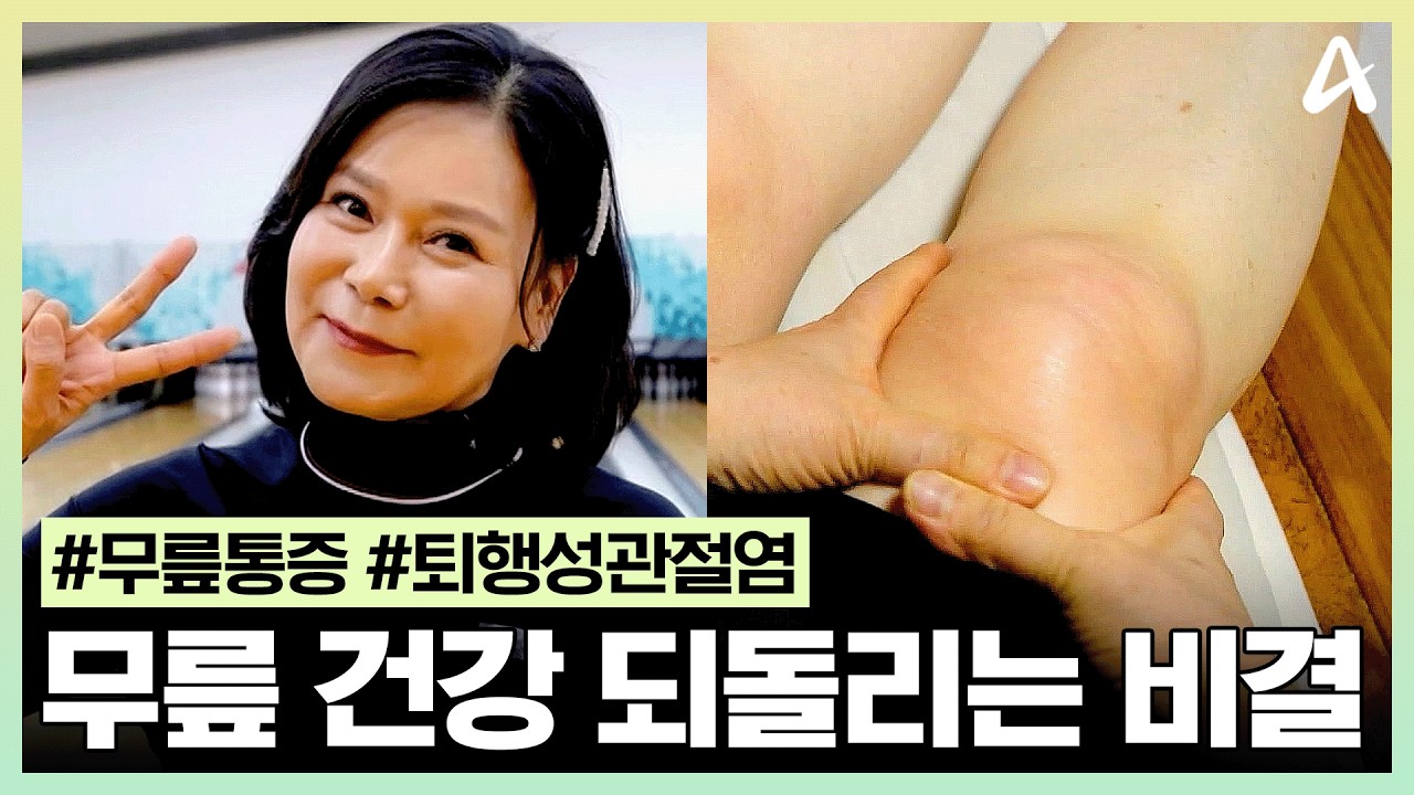 [#건강스페셜한양촌] 무릎 바뀌고 제2의 인생 시작🔥 볼링광 59세의 퇴행성 관절염 탈출 비결은?🎳 | 건강스페셜 한양촌 80회