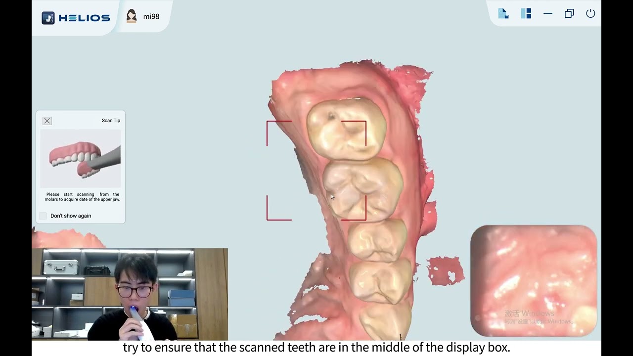 1 Helios 500 Intraoral Scanning Techniques