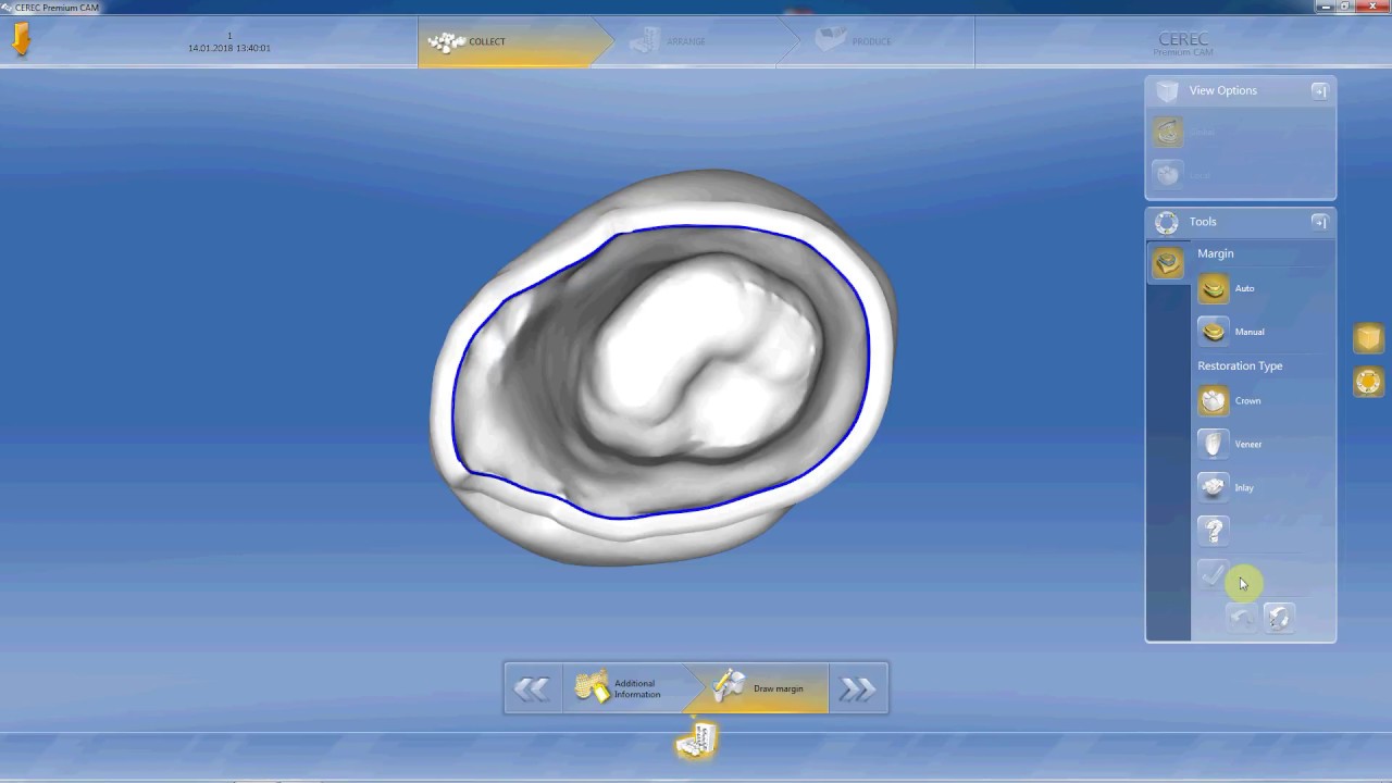 Milling a crown from STL file on Cerec MCXL