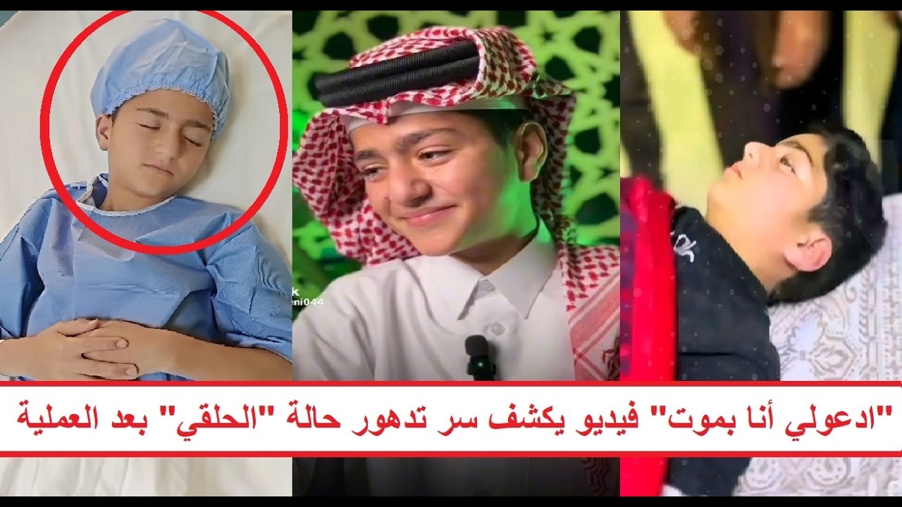 «العملية الثالثة له خلال يومين بسبب الحسد» فيديو يكف الحالة الصحية لـ