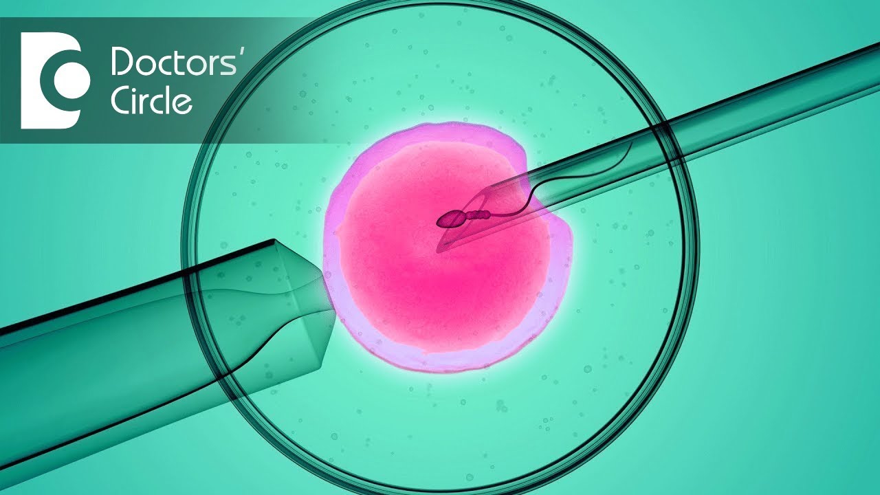 What is natural cycle IVF or organic IVF? - Dr. Mangala Devi KR