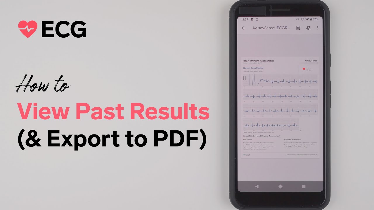 Fitbit Sense ECG &ndash; How to View Past Results (and Export to PDF)