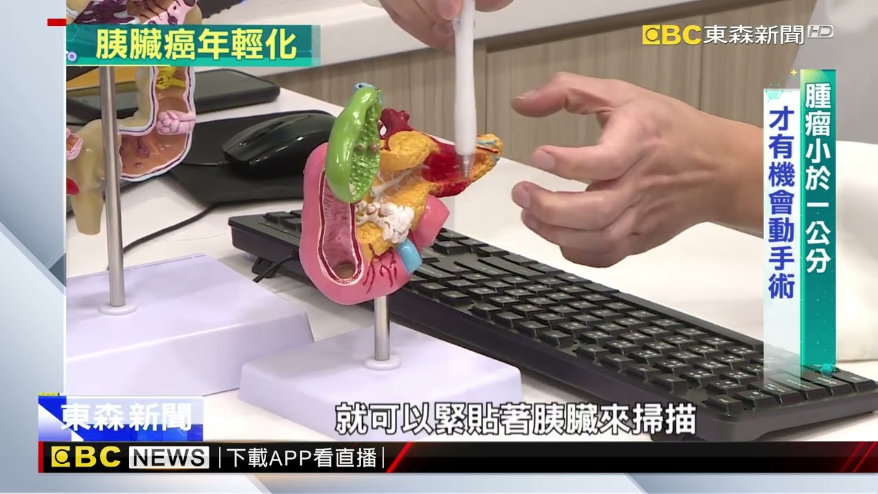 超音波有死角！「癌王」胰臟癌 覺得痛恐已末期@newsebc