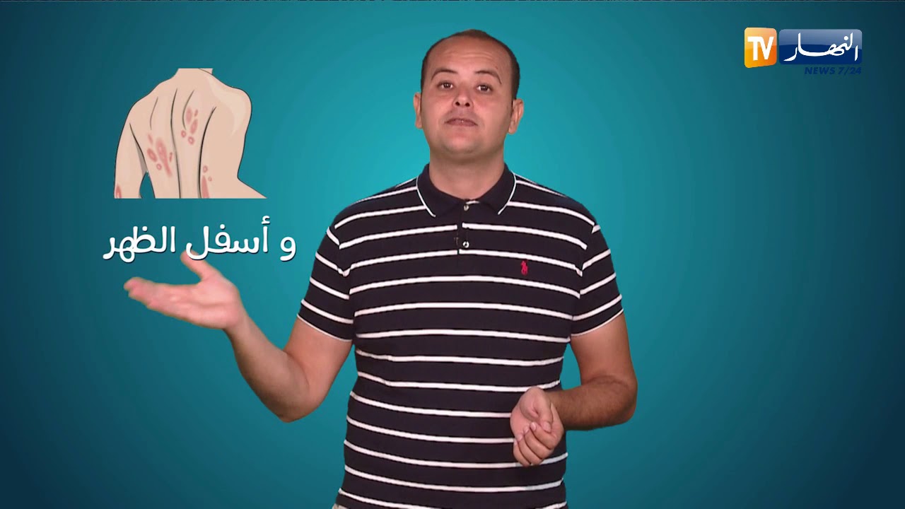 صحة MAG: كيفية وطرق  التخفيف من أعراض الصدفية ؟