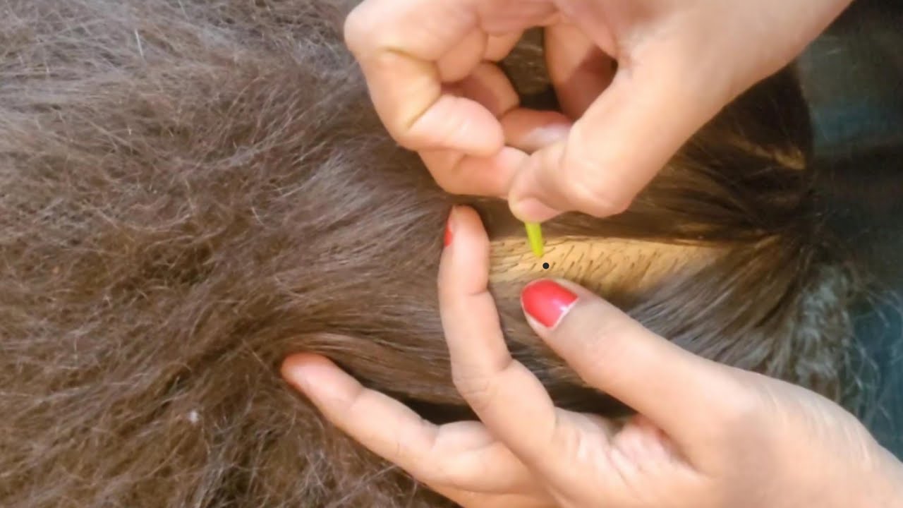 Soothing ASMR Scalp Checking & Tingly Care, (Relax,Focus & Deep Sleep) 💤