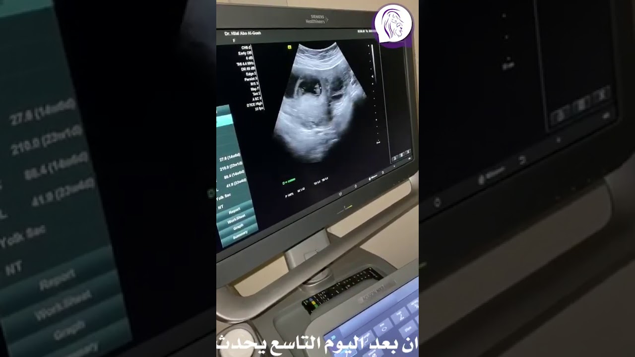 حالة طبية نادرة