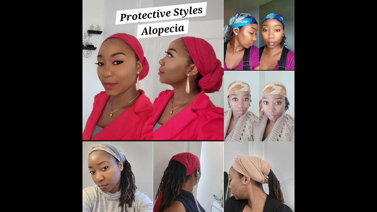 How I Rock My Locs and Conceal Alopecia with Scarves & Headbands | Androgenetic Alopecia | CCCA