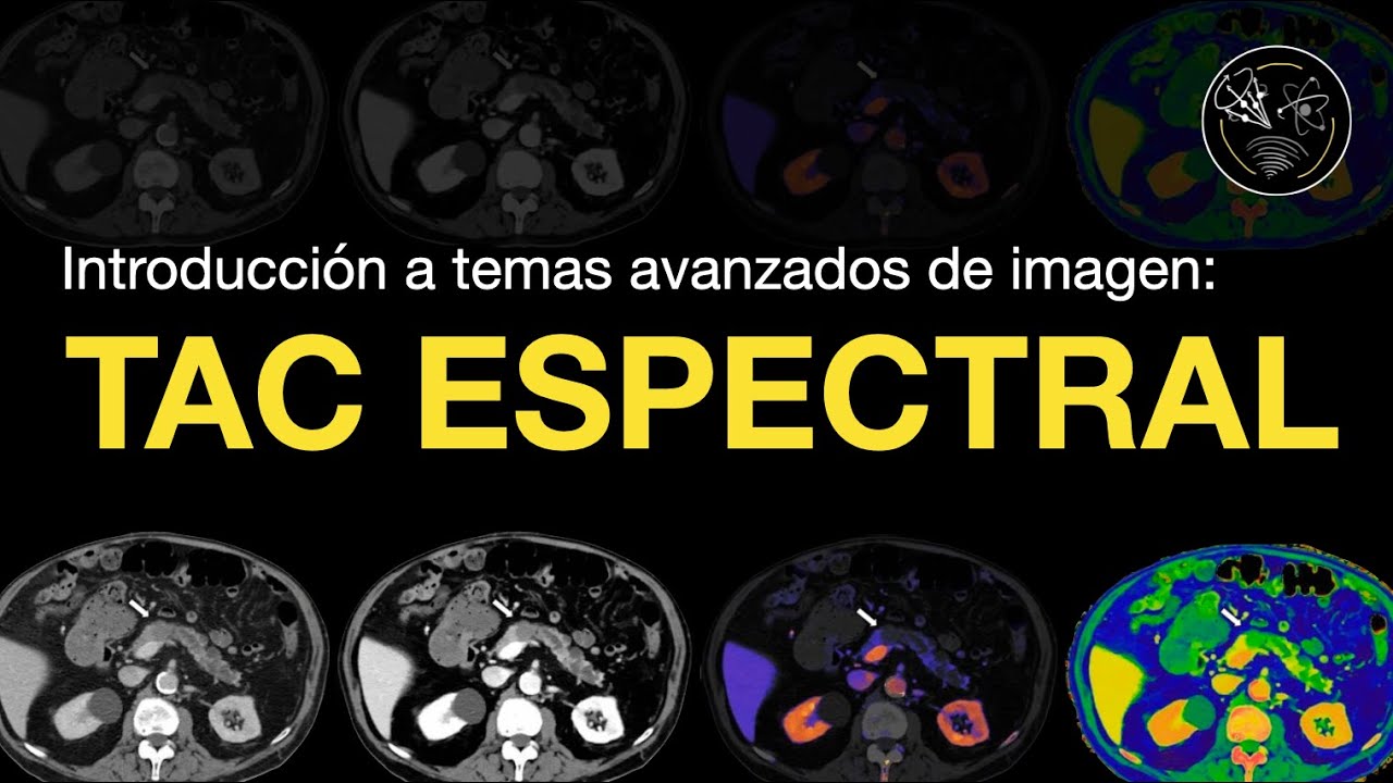 Introducci&oacute;n a: TAC Espectral