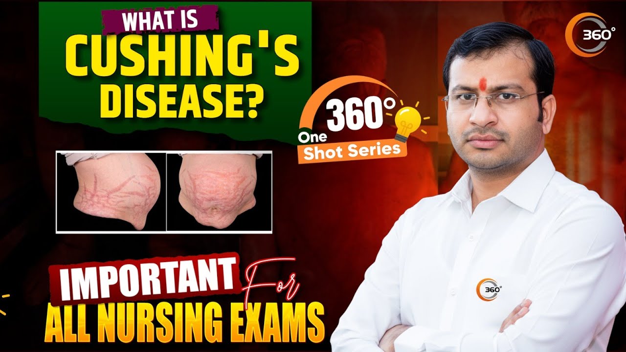What is Cushing's Disease? | 360° One Shot Series 🔥| Siddharth Sandu Sir