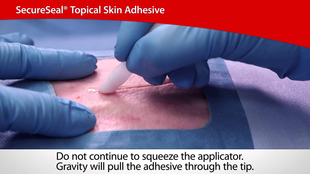SecureSeal® Topical Skin Adhesive | Cardinal Health