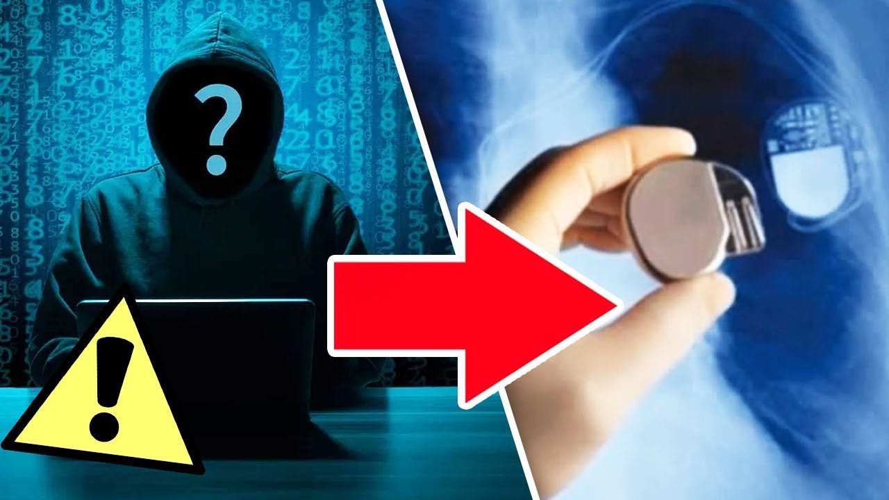 Medical Device Vulnerabilities (Healthcare Hackers Webinar Recording)