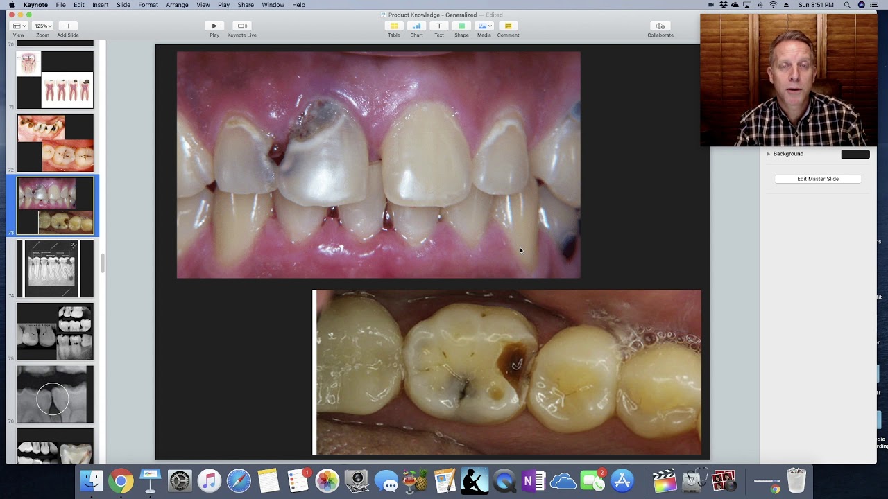 Dental Decay. Education for dental staff.