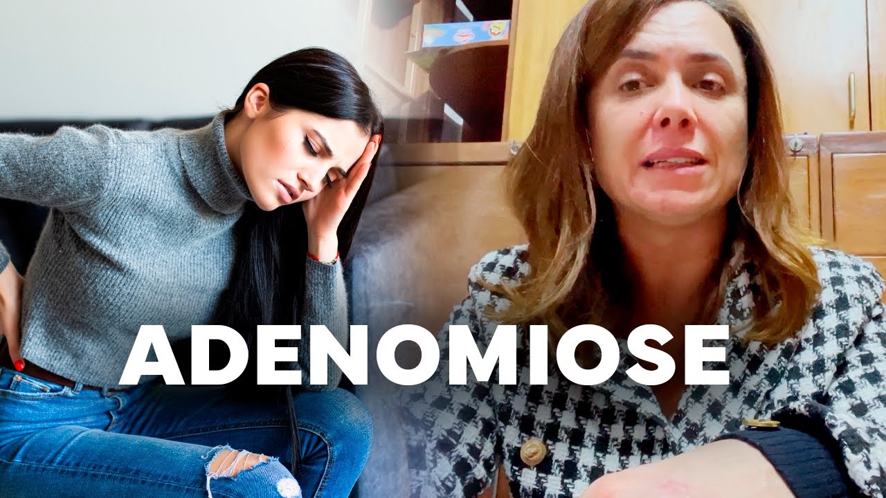 ADENOMIOSE: você precisa saber disso! | Dra Patricia Bretz
