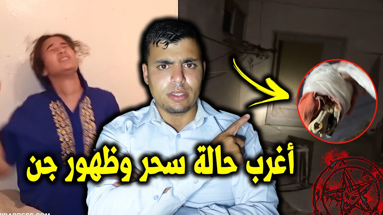 أغرب حالة سحر غادي تشوفها فحياتك 👹👺