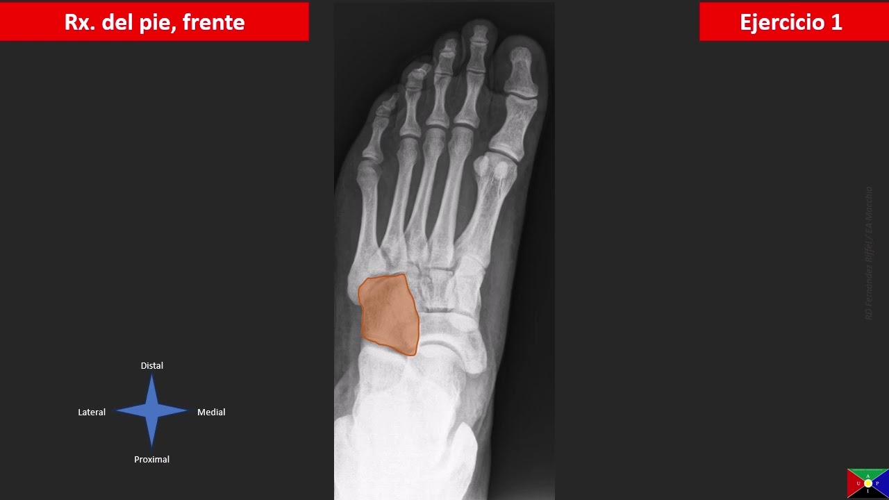 El pie en radiografías de frente - estructuras óseas