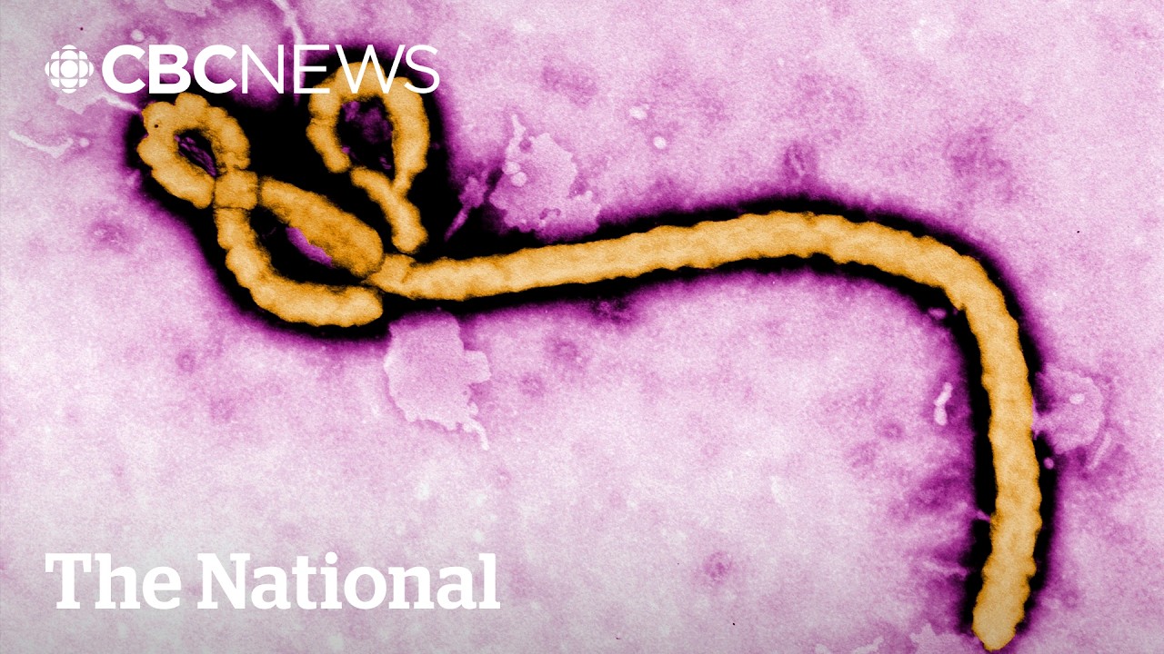 Ebola strain in deadly new Congo outbreak has no vaccine
