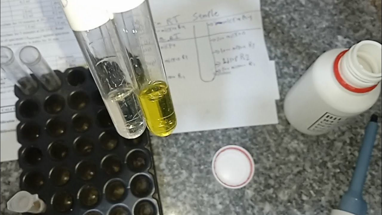 تحليل الصفراء الكلية(Total bilirubin)عملي داخل المعمل خطوة بخطوة