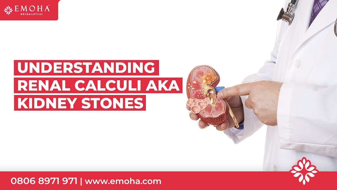 Knowing the ins and outs of Renal Calculi better known as Kidney Stones (29th-Sept-2021)