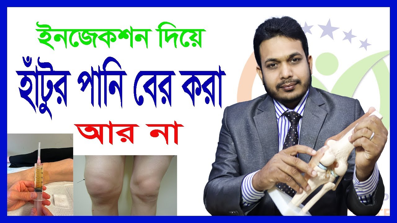 Knee Effusion Treatment Without Injection  হাঁটুর পানি কমানোর প্রাকৃতিক উপায়