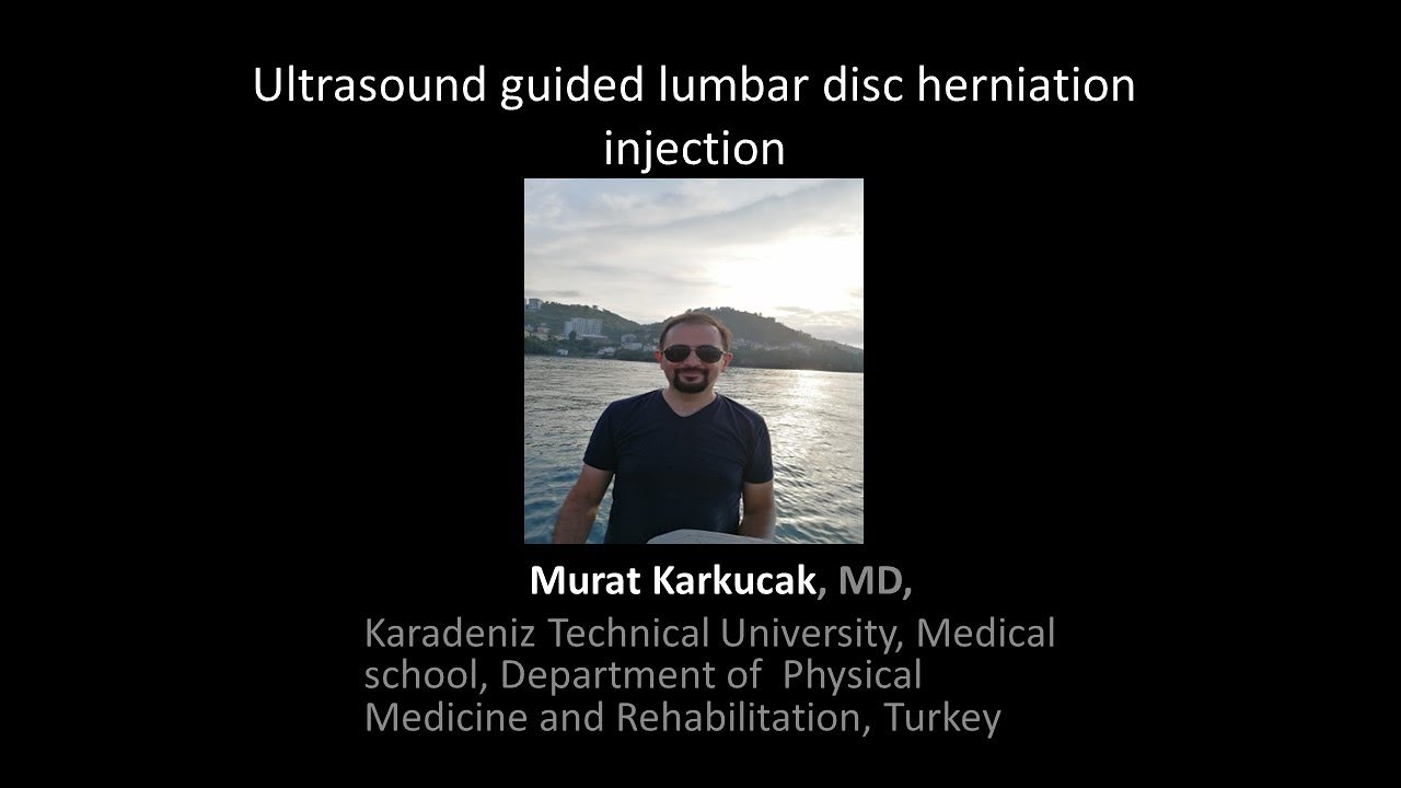 Ultrasound guided lumbar disc herniation injection