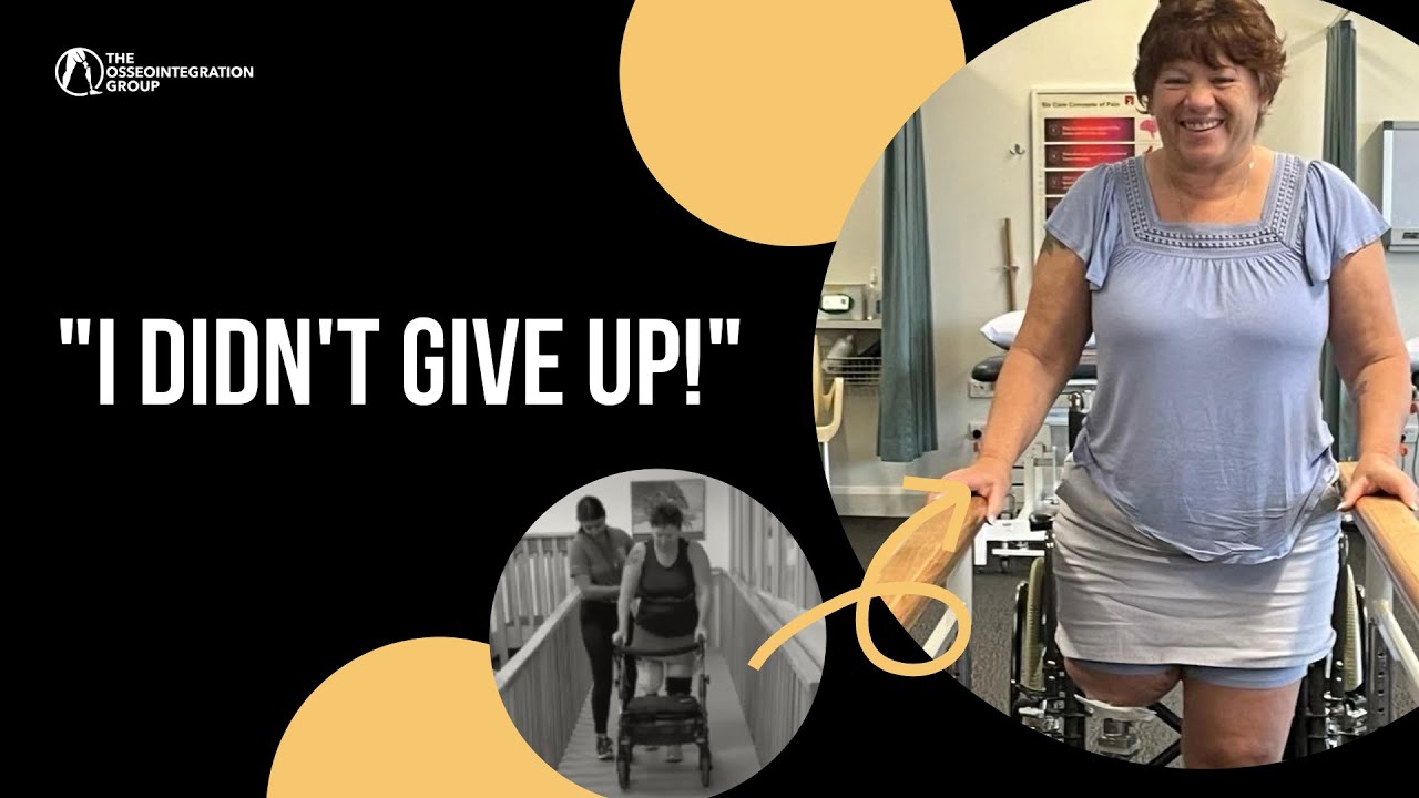 Osseointegration Made Me Feel Like Me Again