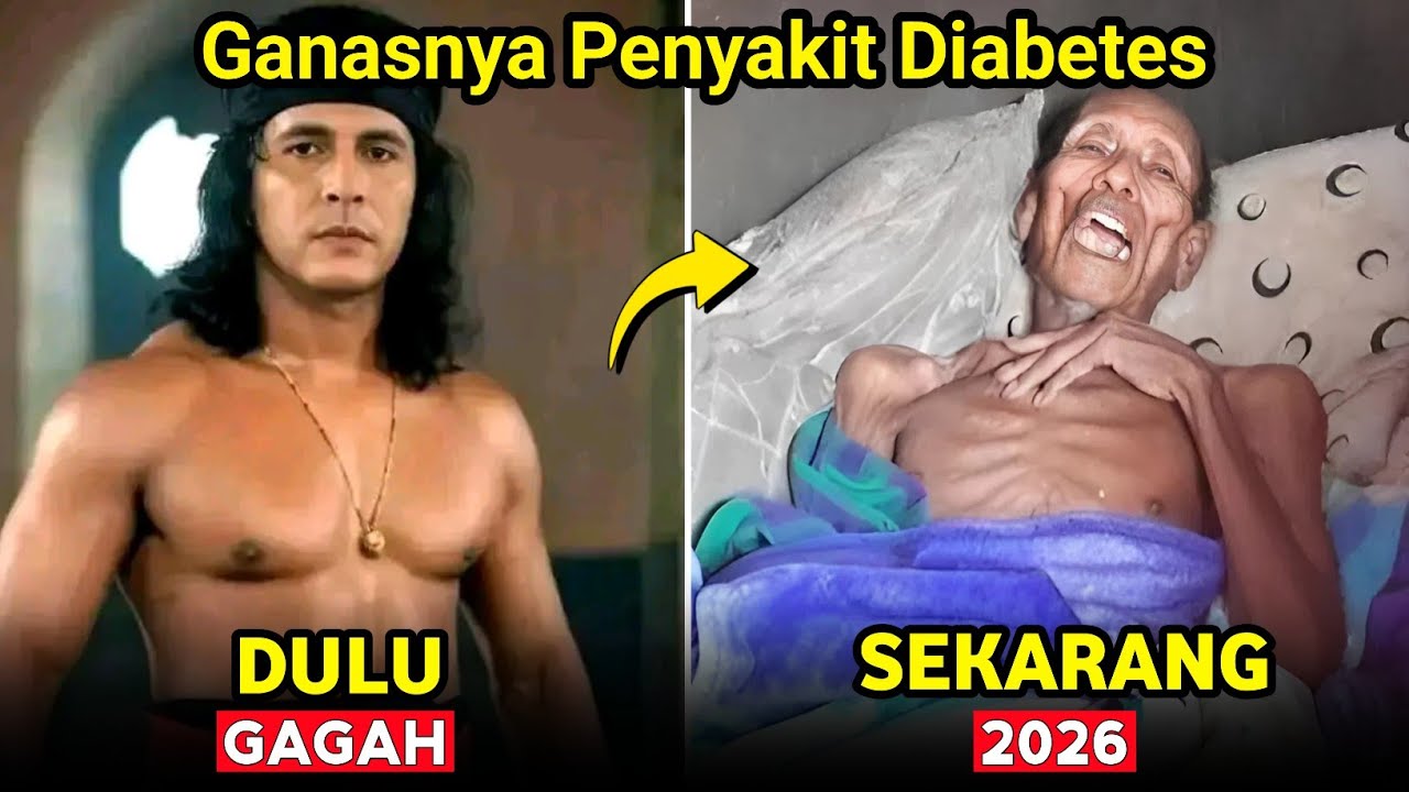 Sangat Miris, 7 Artis Ini Alami Penyakit DIABETES Hingga Meninggal Dunia