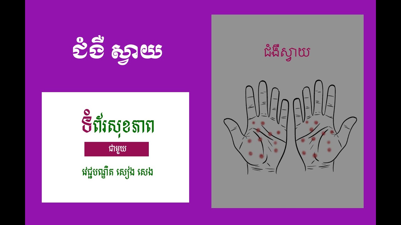 ជំងឺស្វាយ