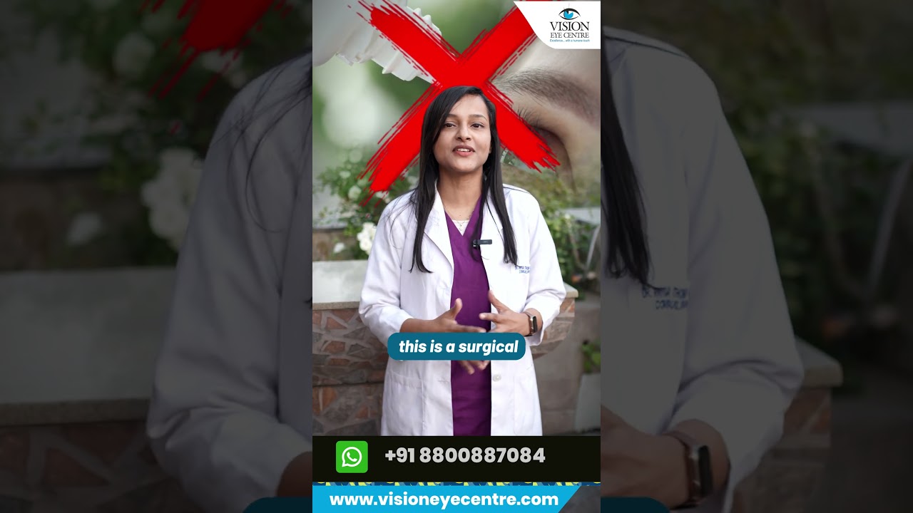 Can Eye Drops Cure Pterygium?  #shorts #pterygium