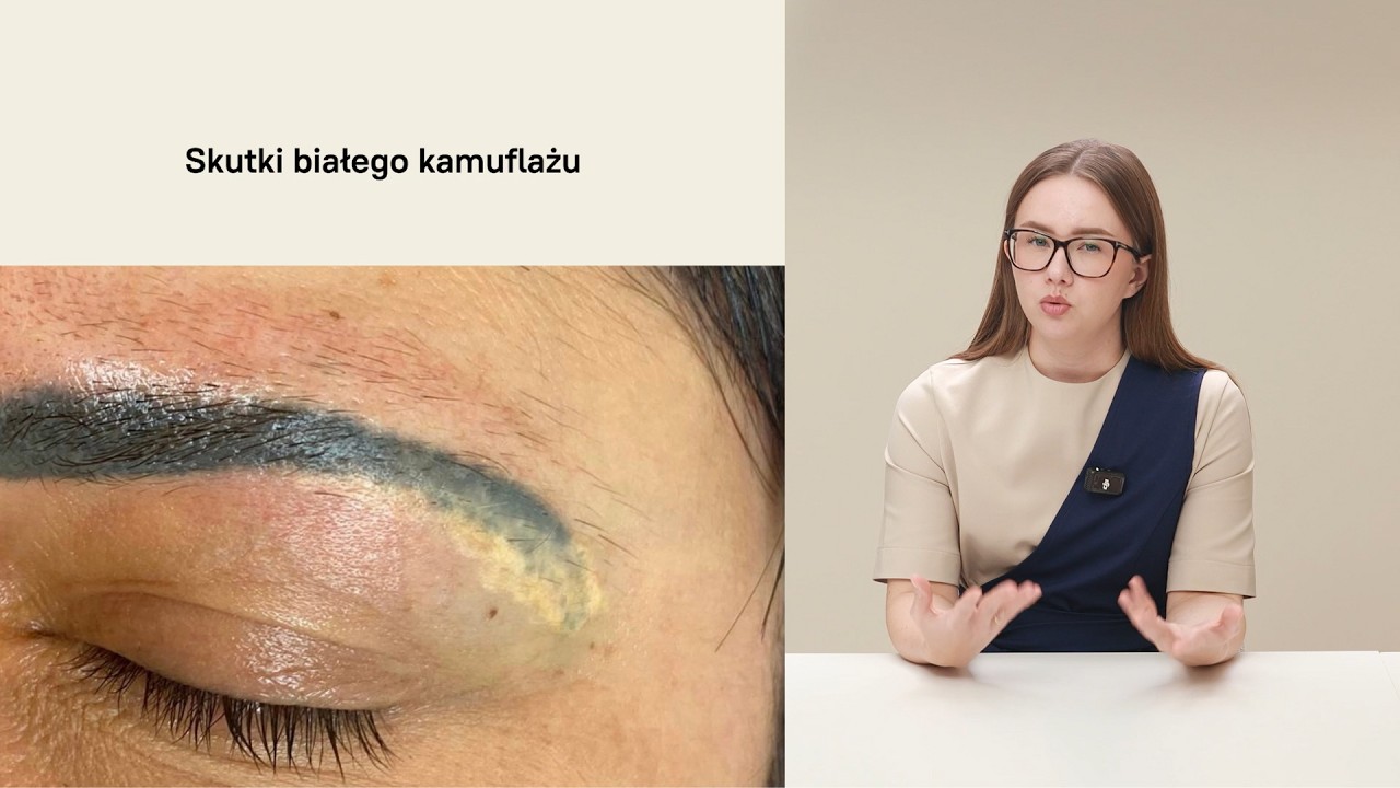 Biel tytanowa - czym jest i czy warto się jej bać?