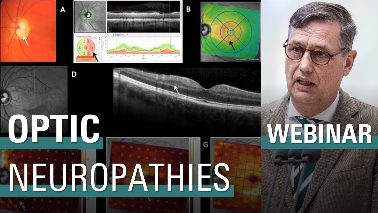 The Glaucoma and Optic Neuropathies Trilogy (May 2020)
