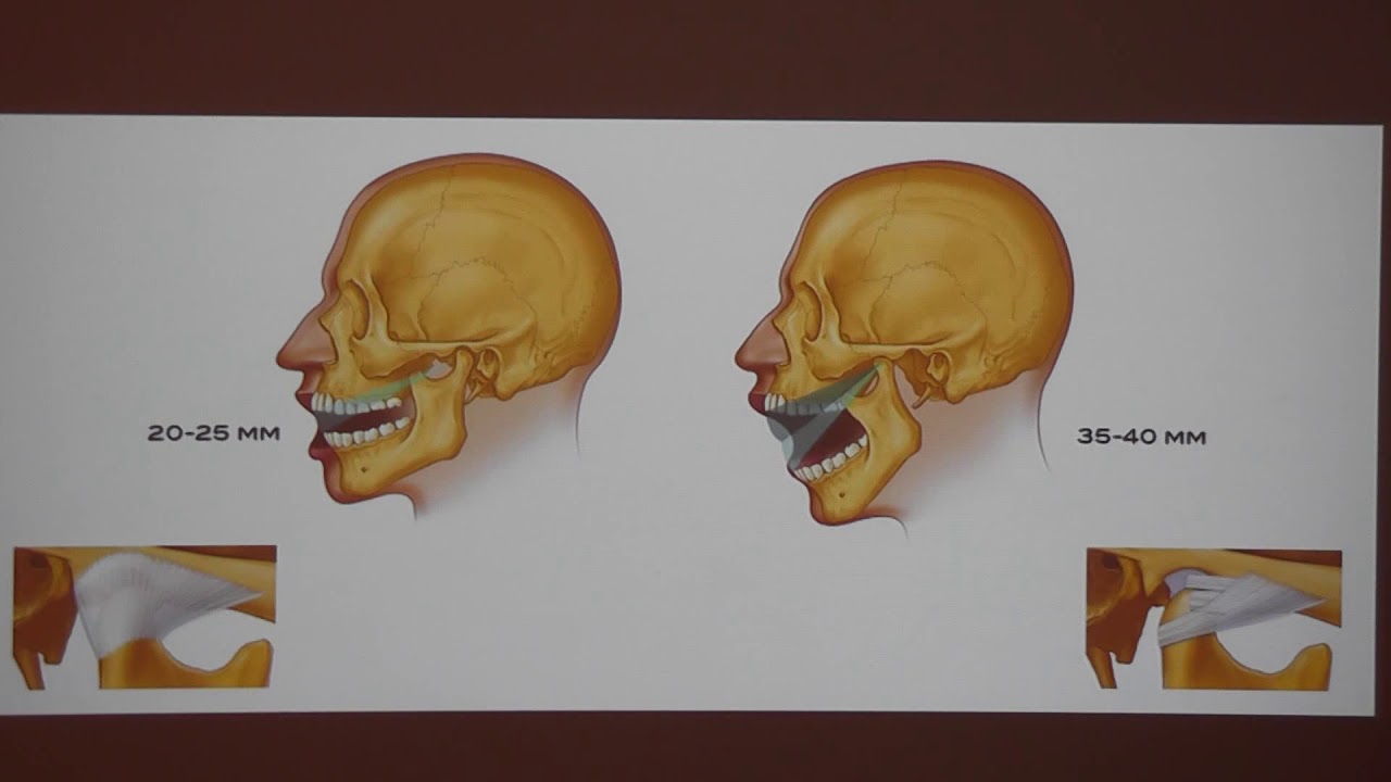 Artikülatör Kullanmazsak Başımız Belaya Girer Mi? / Doç. Dr. Emir Yüzbaşıoğlu