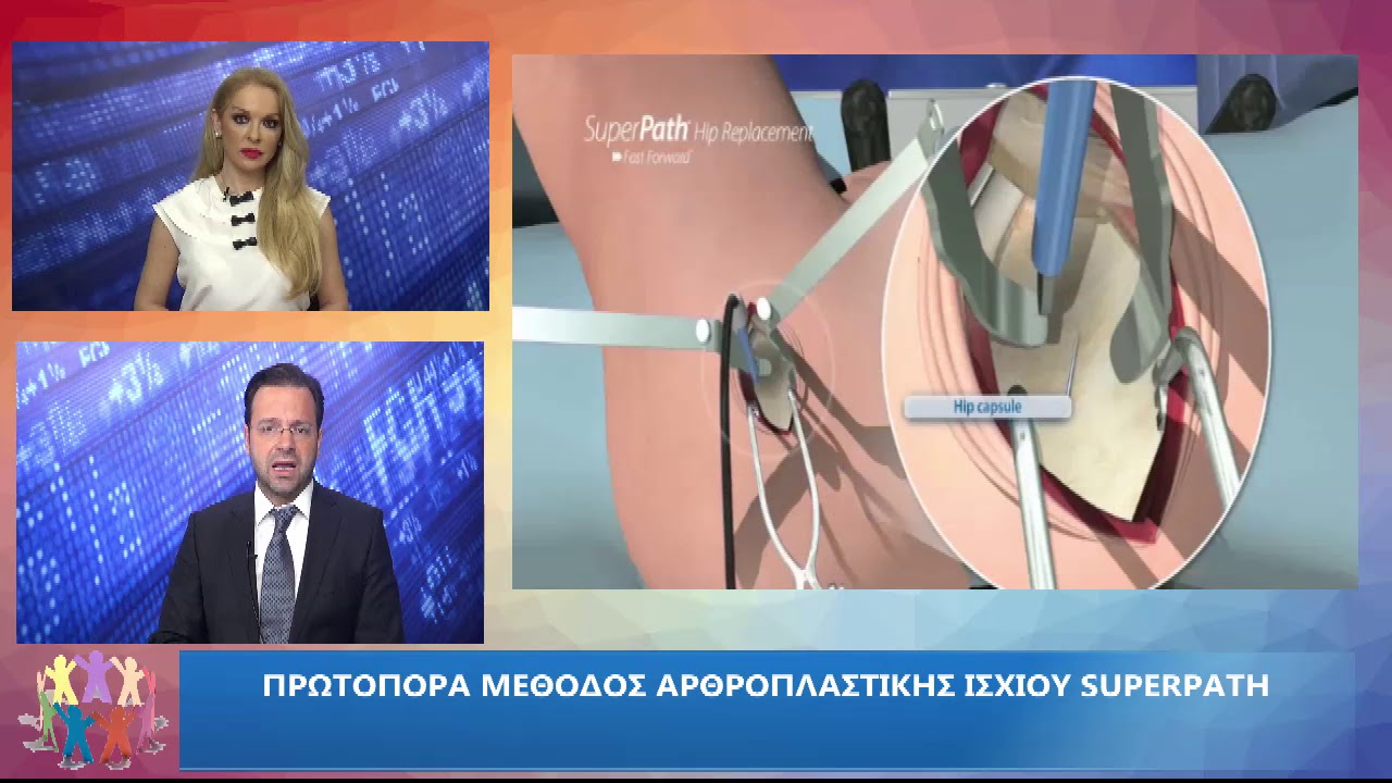 Kontasou. com - Κωνσταντίνος Σαράντος  Ορθοπεδικός -Χειρουργός- Aρθροπλαστική ισχίου